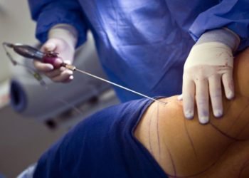 How can you improve liposuction results? 