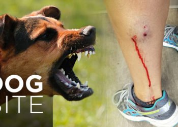 How to decide on a reasonable dog bite accident attorney? 