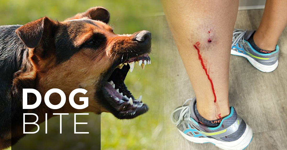 How to decide on a reasonable dog bite accident attorney?