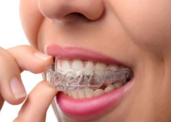 Why should you choose a high-end Invisalign brace to correct your dental structure?