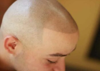 The Risk of Not Trusting the Genuine Artists and Choosing Someone Random for SMP