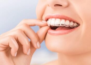 How Long Before My Invisalign Starts Showing Results?