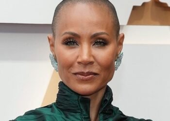 Female Celebrity Hair Loss: A Round-Up of Stars Who Have Struggled with Thinning Hair