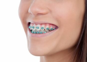 Get Straight Teeth for a Lifetime of Confidence