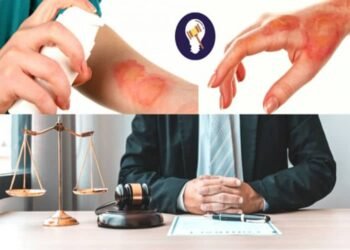 The Common Ways a Burn Injury Can Occur Due to Property Owner Negligence