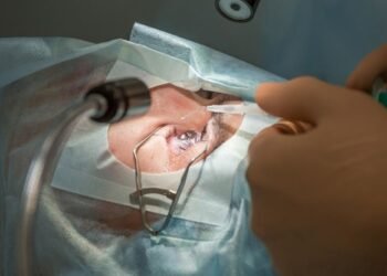 The procedure, Benefits, Risks, Costs, and Recovery Process of Lasik Eye Surgery Explained