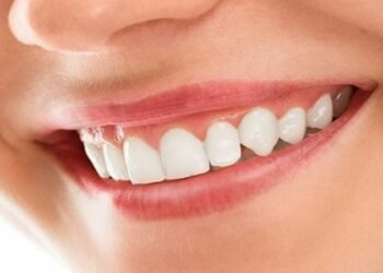 Smile Sculpting: An In-Depth Analysis of Orthodontics and its Transformative Impact on Dental Health