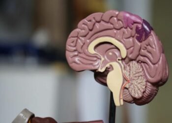 Understanding the Impact of Each Stage of Alzheimer’s Disease
