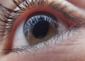 What’s the Difference Between Cataracts and Glaucoma?