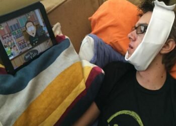 Fun Activities You Can Try Out After Extraction of Your Wisdom Teeth