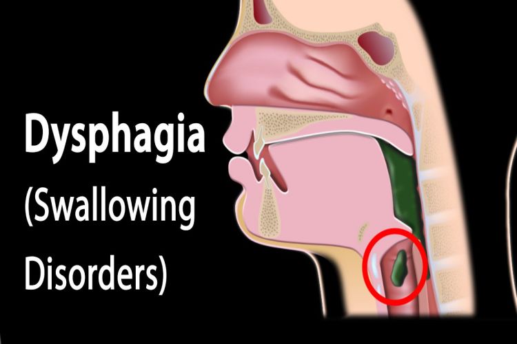 What Can Cause Swallowing Disorders