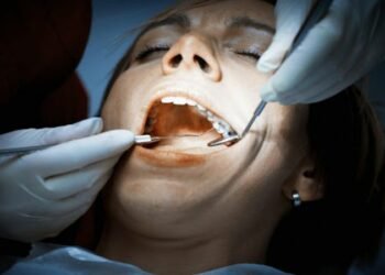 Managing and Treating a Wisdom Tooth Cavity: Expert Tips