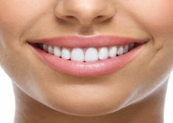 The Surprising Benefits of a Brighter Smile for Your Overall Health