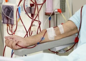 Learn about Hemodialysis, How This Works, and More to Approach This Treatment with a Proper Mindset