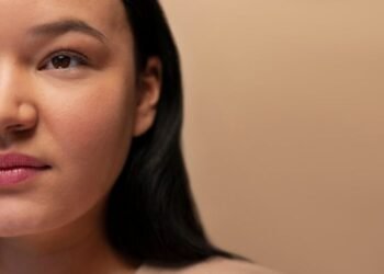 Photography Tips to Avoid Retouching Acne 