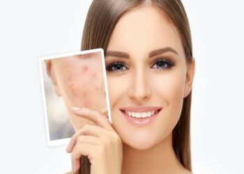 Say Goodbye to Breakouts: Innovative Acne Solutions